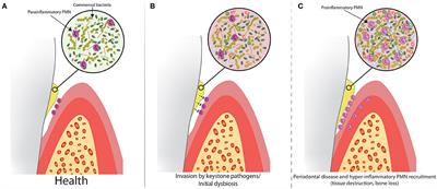 The Neutrophil: Constant Defender and First Responder